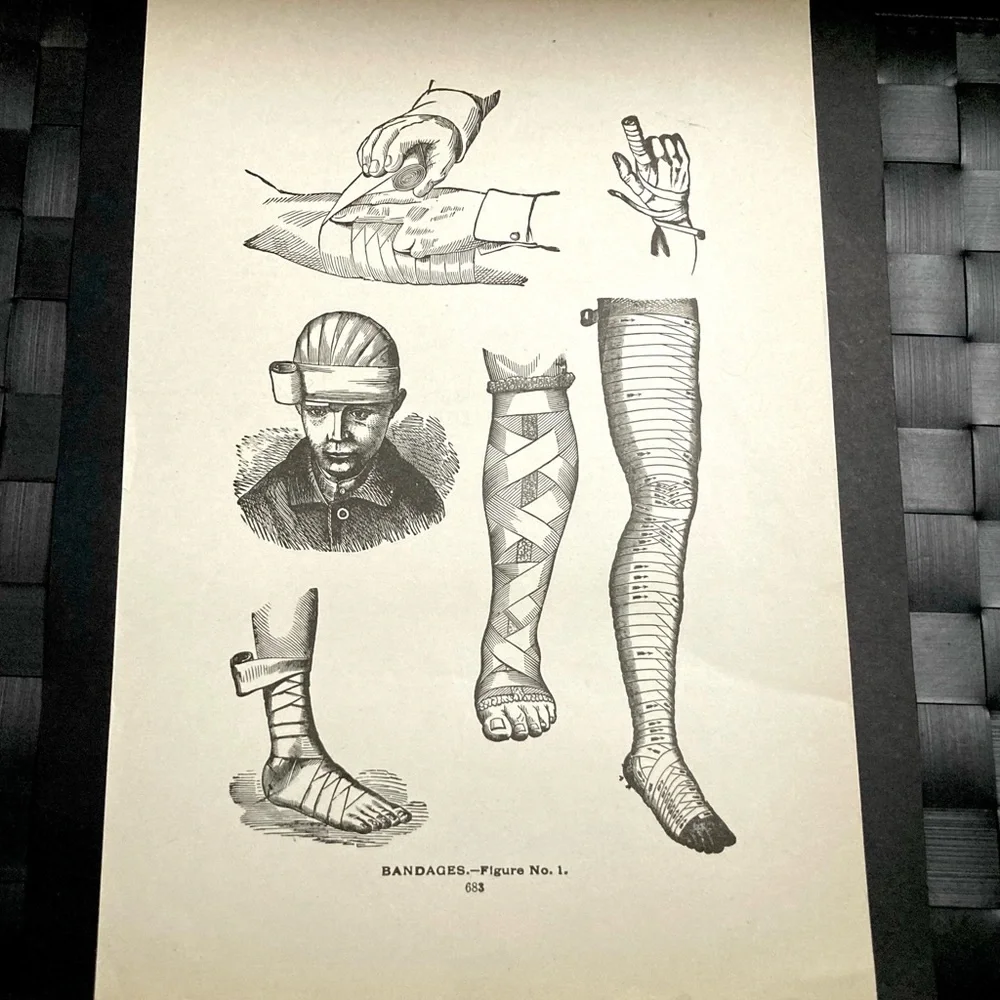 Vintage Medical Diagram | Bandages | Circa 1903